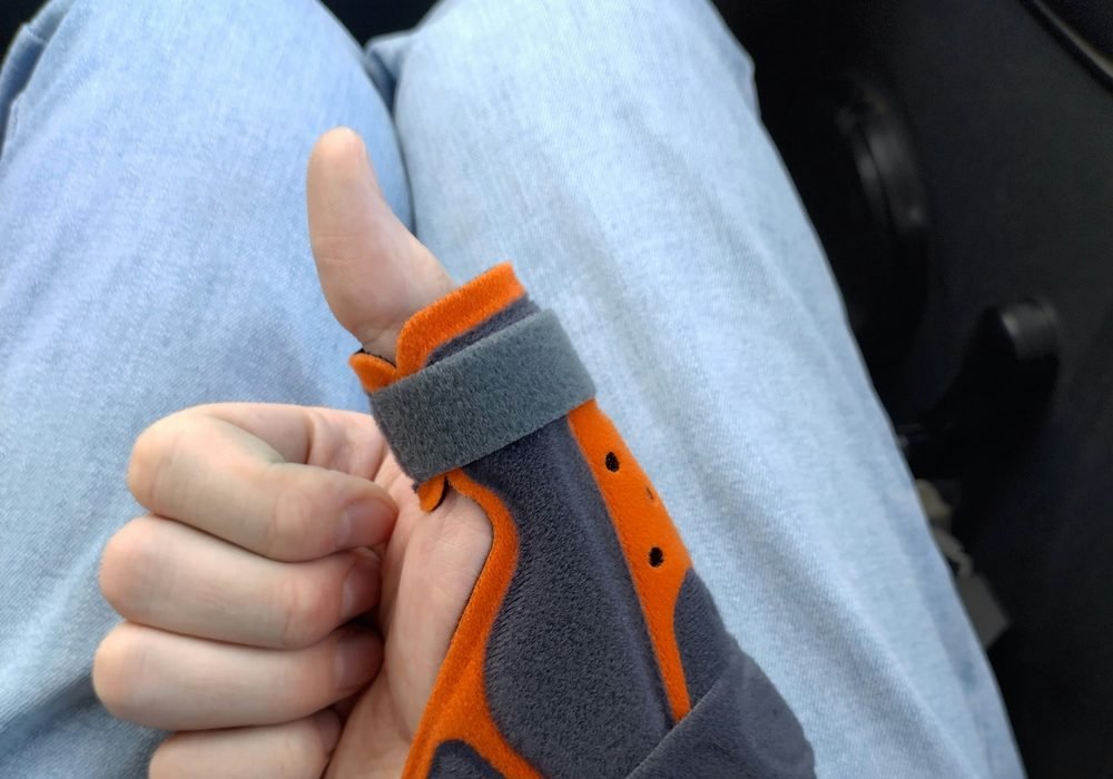 A thumb brace worn on an injured hand